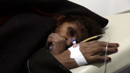 525 orang terinfeksi kolera di Ethiopia