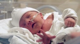 Kasus Langka: Bayi Perempuan Israel Lahir dengan Janin di Rahimnya
