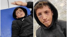 Israel Serang Anak Palestina di Al-Bireh