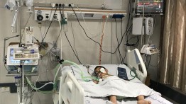 Rumah sakit mata di Gaza melakukan 1,370 operasi sejak awal 2019
