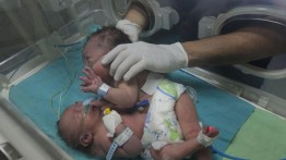 Layanan kebersihan berhenti, 500 operasi di rumah sakit di Gaza tertunda