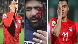 Dua pesepak bola Mesir tunjukkan solidaritas untuk wartawan Palestina korban penembakan Israel