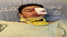Terkena peluru militer Israel, anak Palestina ini terancam kehilangan sebelah matanya