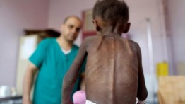 16 Juta Anak-anak di Timur Tengah Menderita Malnutrisi